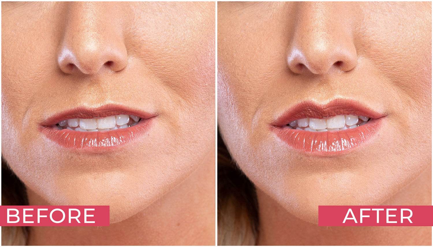 Retouching Lips - before/after