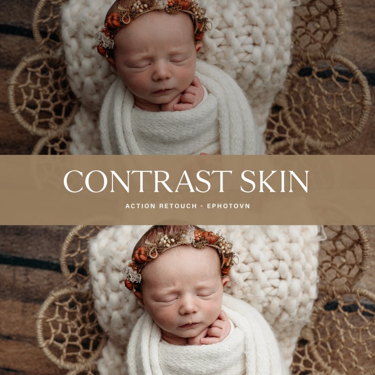 The Contrast Skin Action Collection